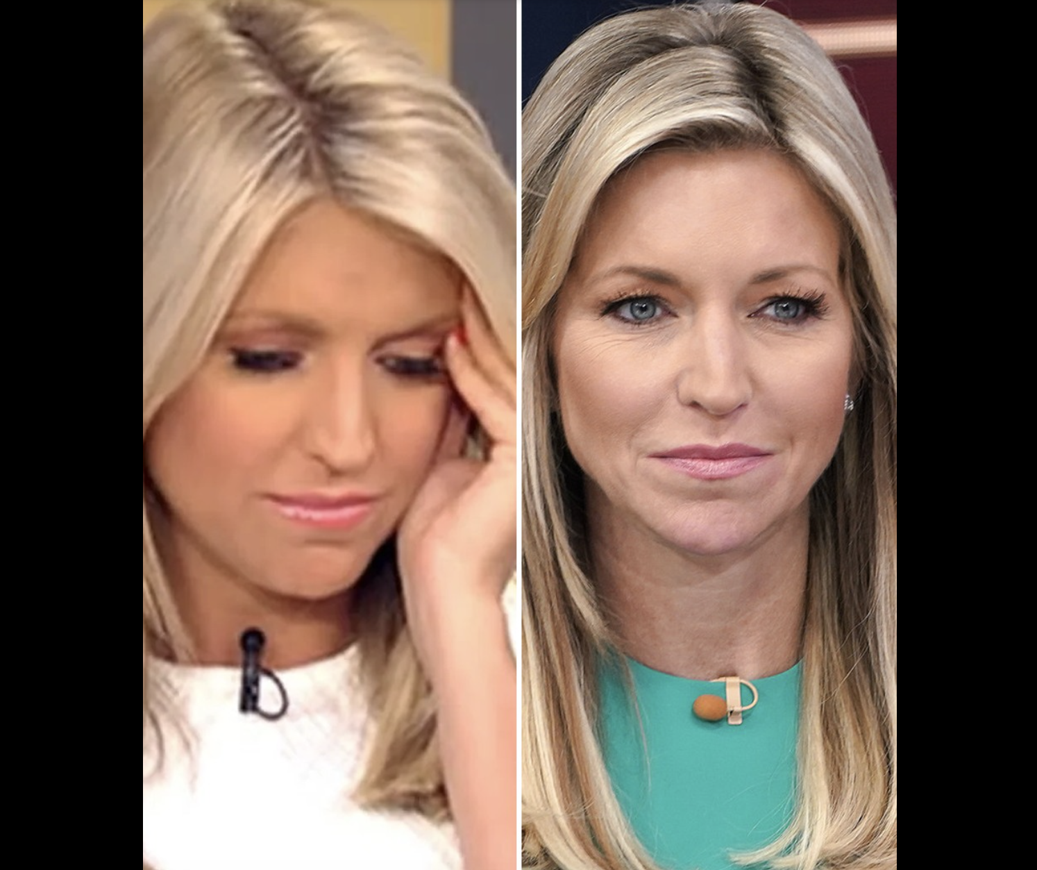 Fox News’ Ainsley Earhardt: A Remarkable Transformation