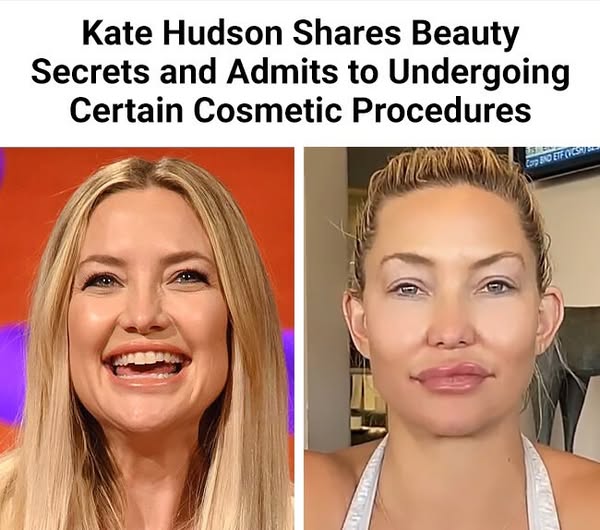 Kate Hudson makes candid confession about cosmetic procedures